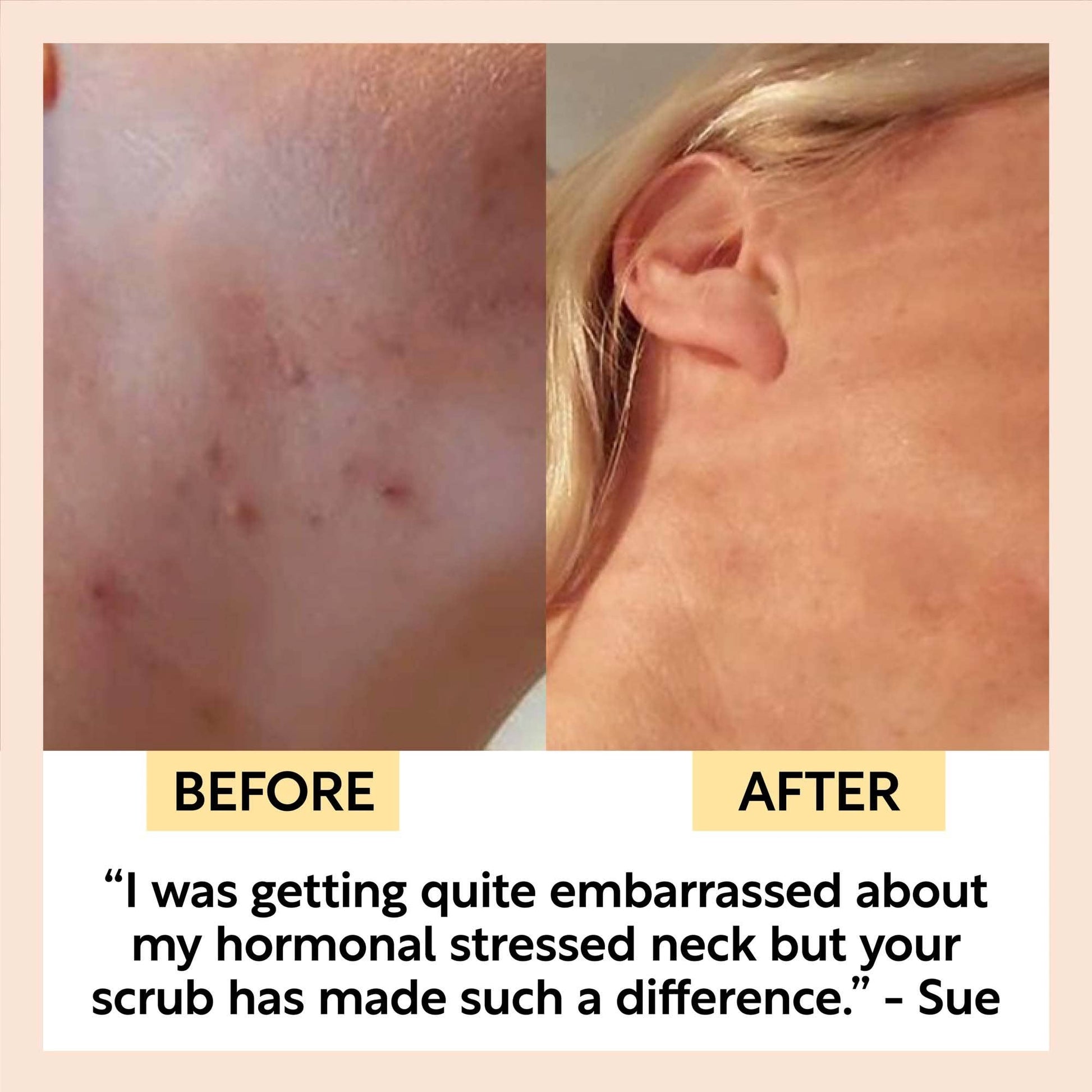 UpCircle Beauty Europe Eco Friendly Coffee Face Scrub [Citrus] Vegan Exfoliator